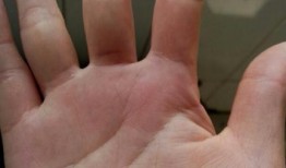 吃瓜的人的手相,手相中的趣味人生