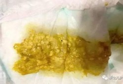 喝了牛奶吃哈密瓜拉肚子,小心肠胃不适